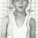 Munro with a metal halo brace after a series of spinal cord operations.